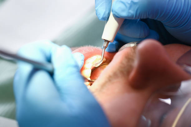 Best Urgent Care for Lost Fillings or Crowns in Double Oak, TX