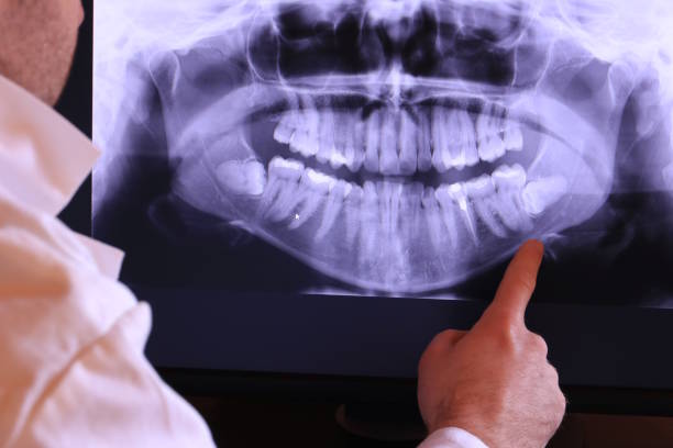Best Emergency Denture Repair in Double Oak, TX